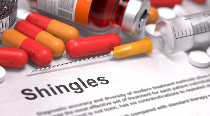 shingles