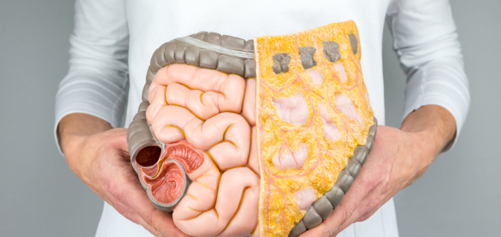 bowel health