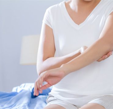 eczema