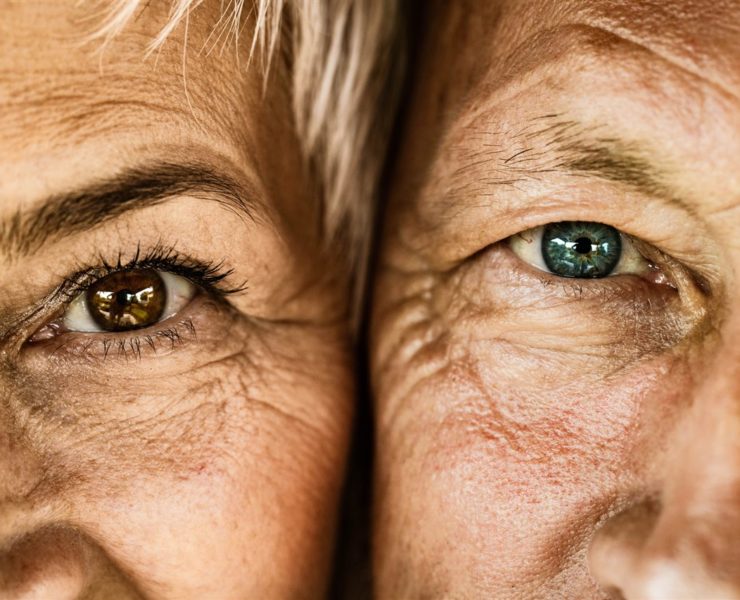 macular degeneration